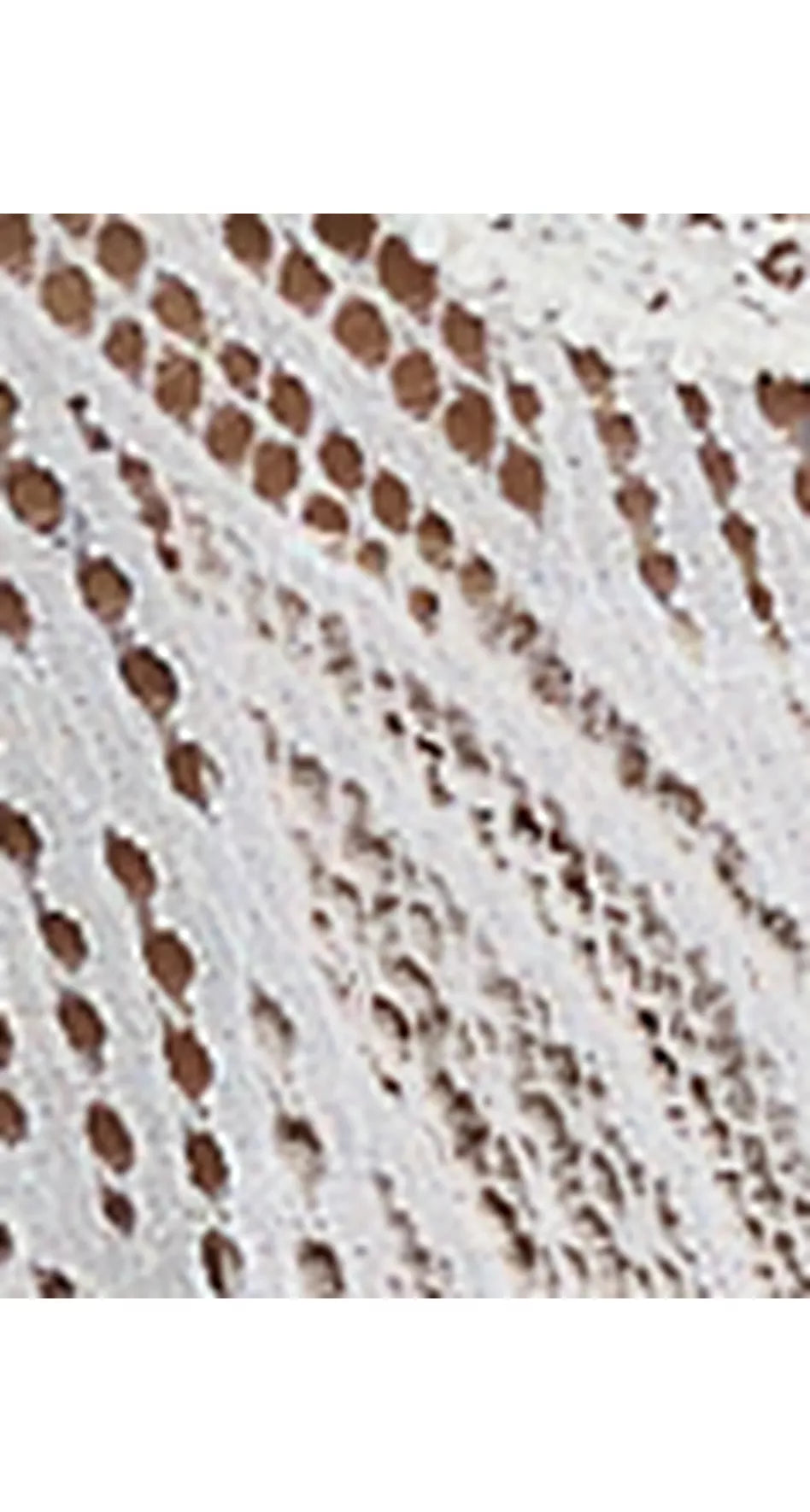 Triumph Lift Smart High Leg Brazilian Briefs - McGrocer