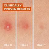 Biore Spot Control 3-in-1 Spot Patches