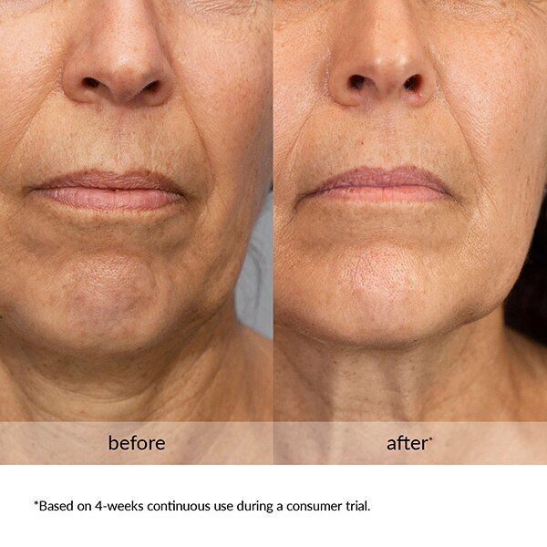 Avon Anew Platinum Lift & Tighten Serum - McGrocer