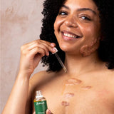 Balmonds Rosehip Scar Oil 50ml - McGrocer