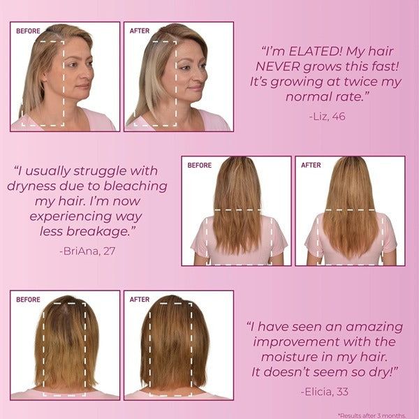 BosleyMD Hair Loss Conditioner MendXtend 1 Litre - McGrocer