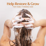 BosleyMD Hair Loss Conditioner Revive Colour Safe 300ml - McGrocer