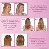 BosleyMD Hair Loss Prevention Starter Pack MendXtend - McGrocer