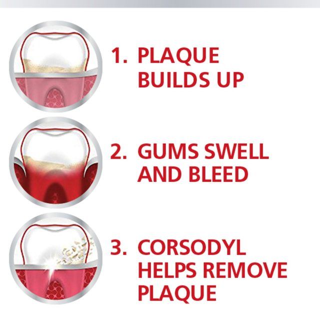Corsodyl Gum Mouthwash Intensive Treatment For Gum Health Mint 300ml