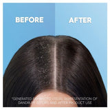 Head&Shoulders Deep Hydration AntiDandruff Shampoo 400ml