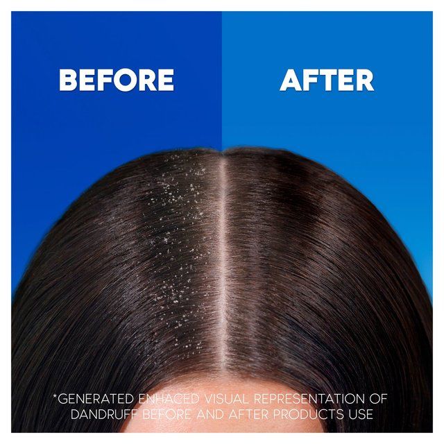 Head & Shoulders Deep Hydration Hair Conditioner 275ml