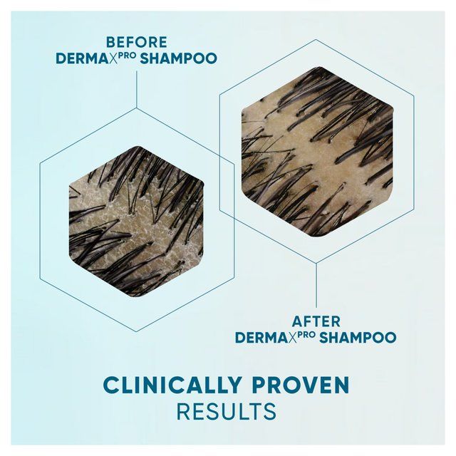 Head & Shoulders Derma X Pro Soothe Shampoo 300ml