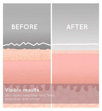 HoMedics Radiance Microdermabrasion