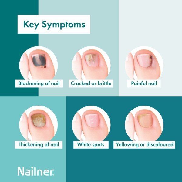 Nailner Treat & Colour