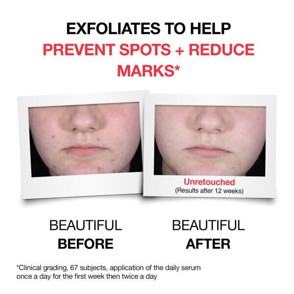 Neutrogena Clear Defend + Wash 200ml