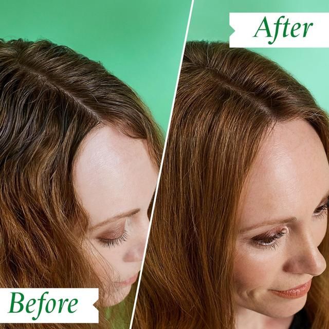 Philip Kingsley Flaky Itchy Regime Kit 190ml