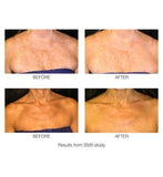 Rio DecoLITE Beauty boost LED light Treatment