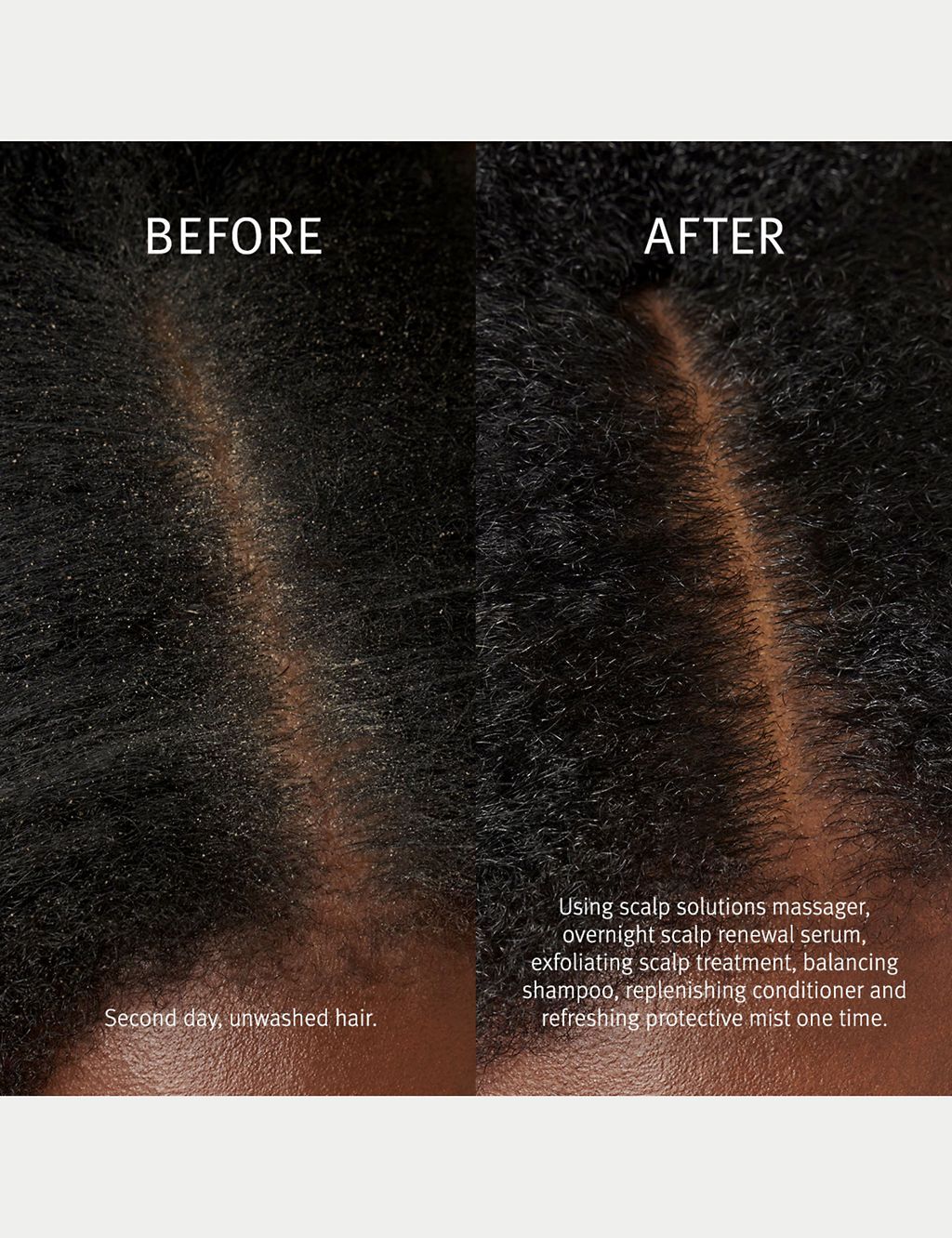 Scalp Solutions Stimulating Scalp Massager