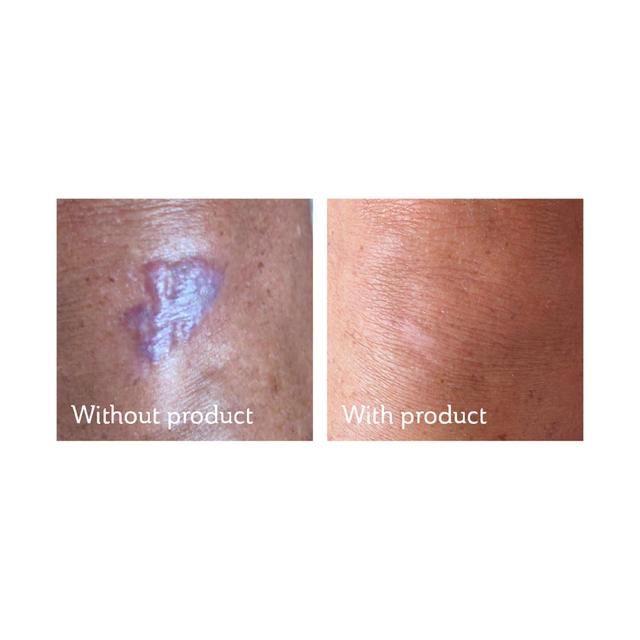 Science of Skin Solution for Scars 30ml