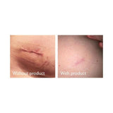 Science of Skin Solution for Scars 30ml