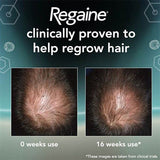 Regaine For Men Foam Hair Re-Growth with Minoxidil 1 x 73ml GOODS Superdrug   