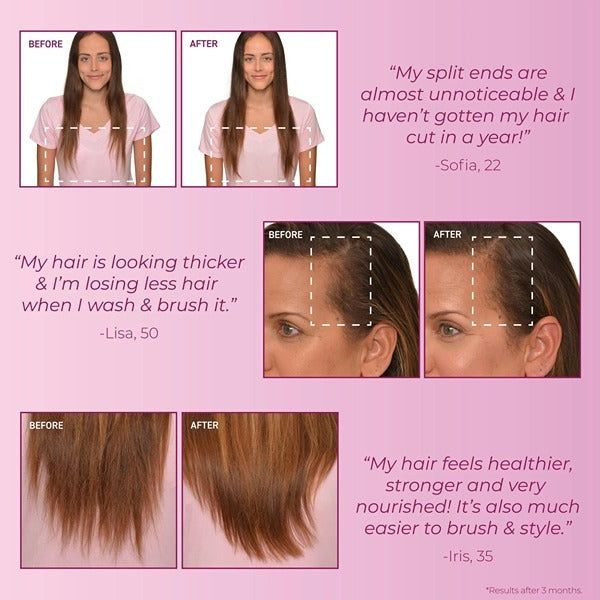 BosleyMD Hair Loss Shampoo MendXtend 300ml - McGrocer