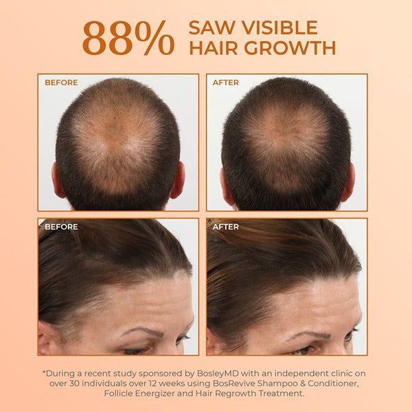 BosleyMD Hair Loss Shampoo Revive Colour Safe 300ml - McGrocer