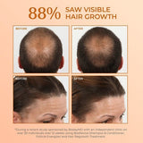 BosleyMD Hair Loss Shampoo Revive Colour Safe 300ml - McGrocer