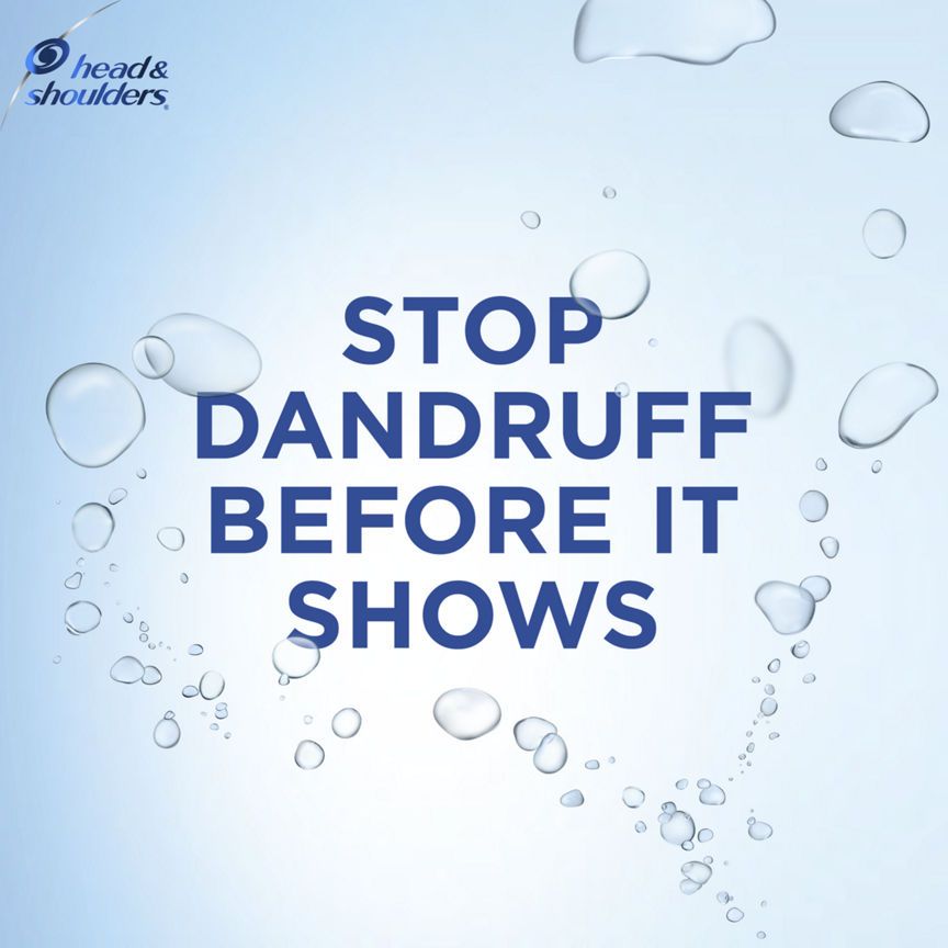 Head &amp;amp; Shoulders Citrus Fresh Anti Dandruff Shampoo