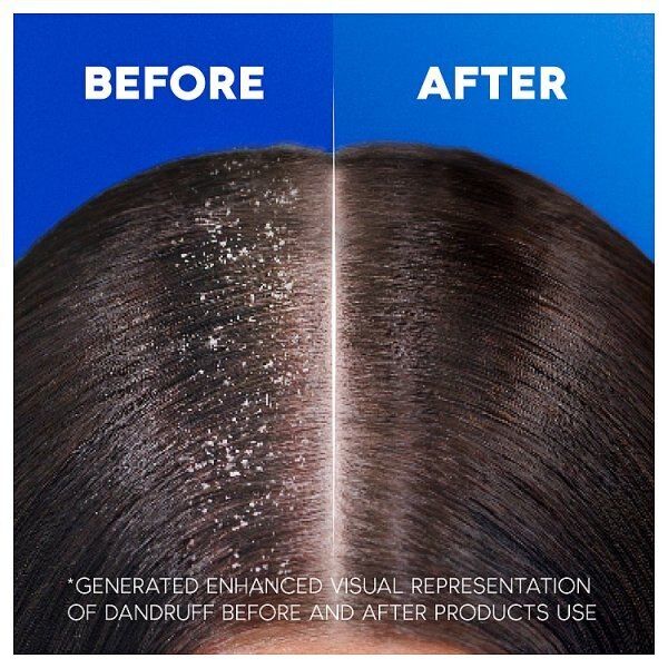 Head &amp;amp; Shoulders Smooth &amp;amp; Silky Anti-Dandruff Shampoo 400Ml
