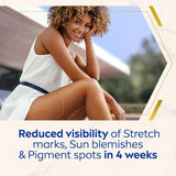 NIVEA Luminous 630 Anti-Stretch Marks &amp;amp; Dark Spots Body Cream   100ml