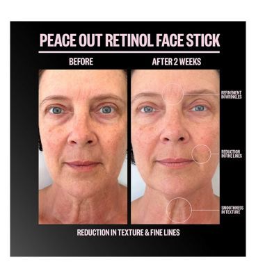 Peace Out Retinol Face Stick 8g