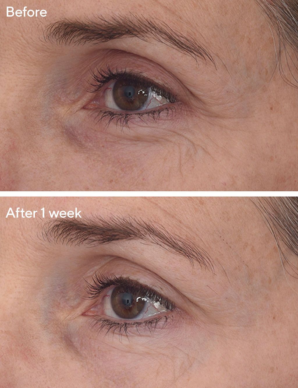Retinal ReSculpt&amp;trade; Eye Treatment 15ml